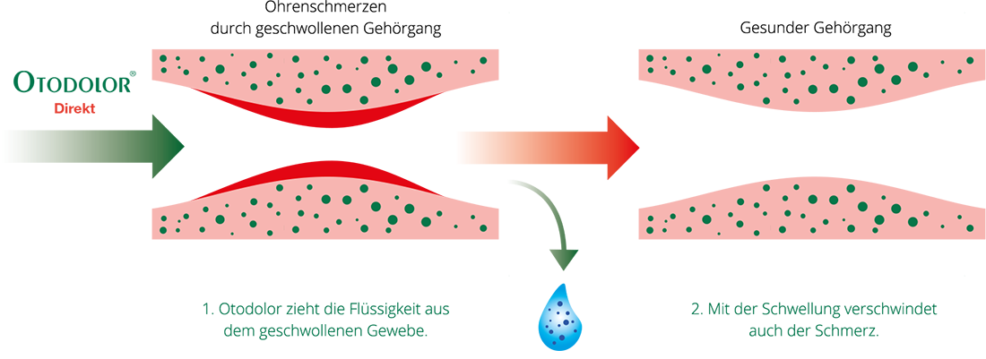 So funktioniert Otodolor